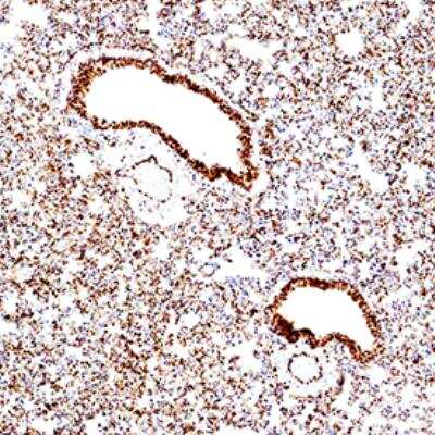 Immunohistochemistry-Paraffin: ACE-2 Antibody (AC18F) - Azide and BSA Free [NBP2-80035]