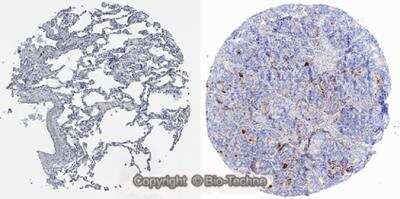 Immunohistochemistry-Paraffin: ACE-2 Antibody (AC384) - Azide and BSA Free [NBP2-80038]