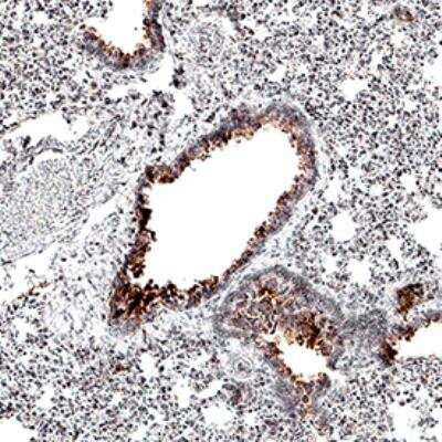 Immunohistochemistry-Paraffin: ACE-2 Antibody (AC384) - Azide and BSA Free [NBP2-80038]