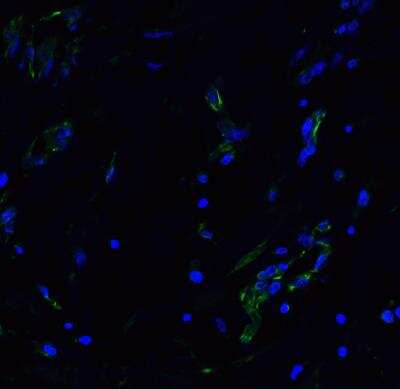 Immunocytochemistry/ Immunofluorescence: ACE-2 Antibody - BSA Free [NBP1-76614]
