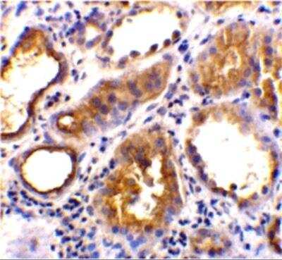 Immunohistochemistry-Paraffin: ACE-2 Antibody - BSA Free [NBP1-76614]