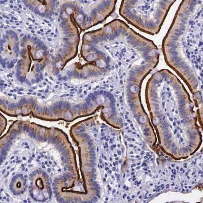 Immunohistochemistry-Paraffin: ACE-2 Antibody [NBP1-88123]