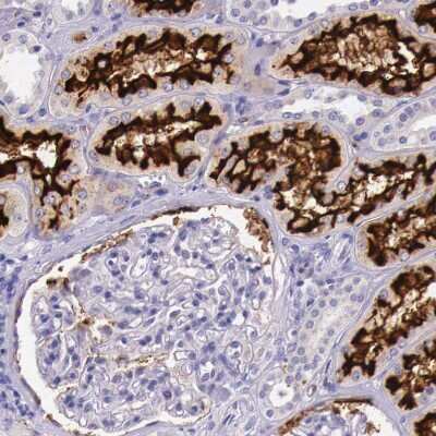 Immunohistochemistry-Paraffin: ACE-2 Antibody [NBP1-88123]