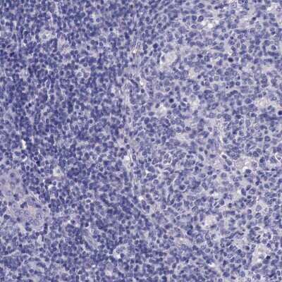 Immunohistochemistry-Paraffin: ACE-2 Antibody [NBP1-88123]