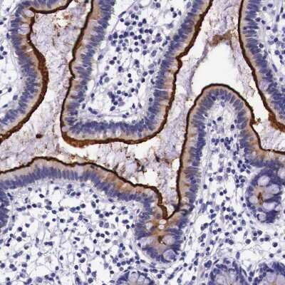 Immunohistochemistry-Paraffin: ACE-2 Antibody [NBP1-88123]