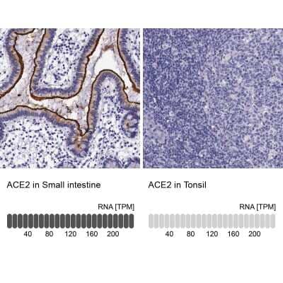 Immunohistochemistry-Paraffin: ACE-2 Antibody [NBP1-88123]