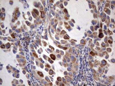 Immunohistochemistry-Paraffin: ACE-2 Antibody (OTI4D2) - Azide and BSA Free [NBP2-72117]