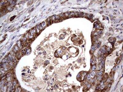Immunohistochemistry-Paraffin: ACE-2 Antibody (OTI4D2) - Azide and BSA Free [NBP2-72117]