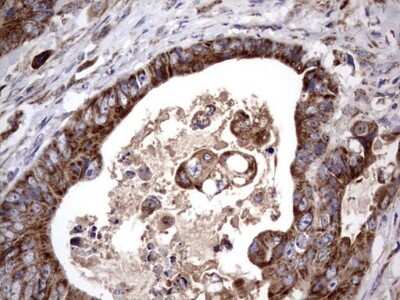 Immunohistochemistry: ACE-2 Antibody (OTI4D2) [NBP2-46490]