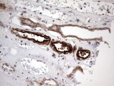 Immunohistochemistry: ACE-2 Antibody (OTI4D2) [NBP2-46490]