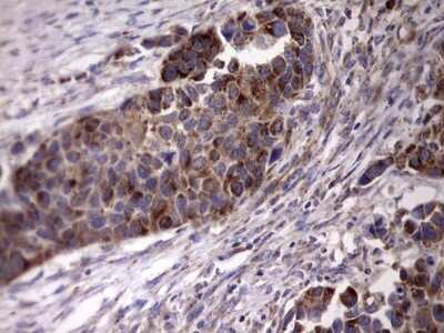 Immunohistochemistry: ACE-2 Antibody (OTI4D2) [NBP2-46490]
