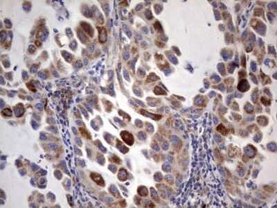 Immunohistochemistry: ACE-2 Antibody (OTI4D2) [NBP2-46490]