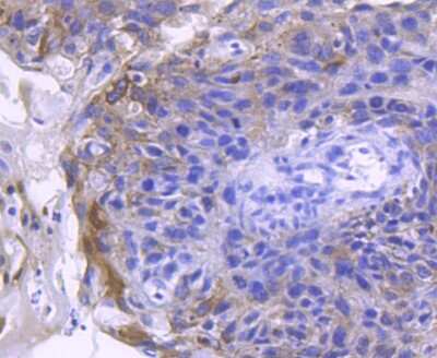 Immunohistochemistry-Paraffin: ACE-2 Antibody (SN0754) [NBP2-67692]