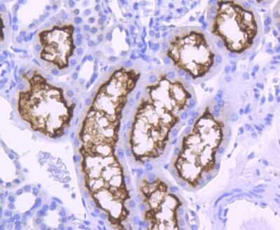 Immunohistochemistry-Paraffin: ACE-2 Antibody (SN0754) [NBP2-67692]