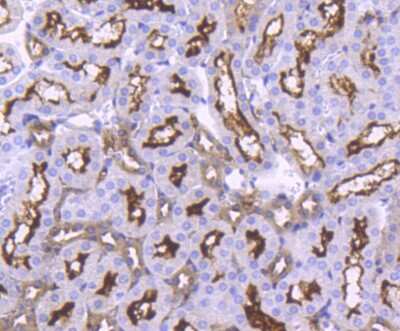 Immunohistochemistry-Paraffin: ACE-2 Antibody (SN0754) [NBP2-67692]