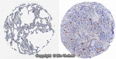 Immunohistochemistry-Paraffin: ACE-2 Antibody (SN0754) [NBP2-67692]