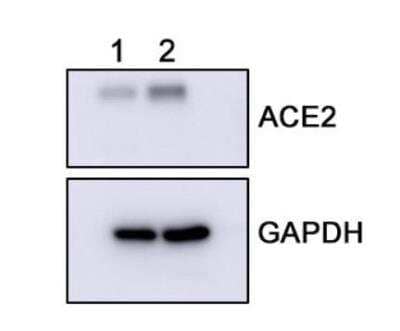 Western Blot: ACE-2 Antibody (SN0754) [NBP2-67692]