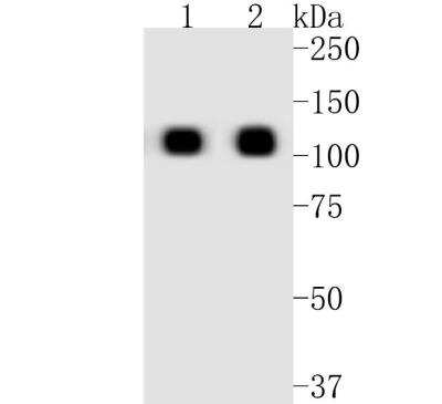 Western Blot: ACE-2 Antibody (SN0754) [NBP2-67692]