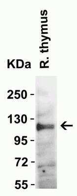 Western Blot: ACE-2 AntibodyBSA Free [NBP1-76611]