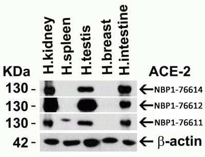 Western Blot: ACE-2 AntibodyBSA Free [NBP1-76611]