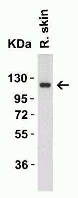 Western Blot: ACE-2 AntibodyBSA Free [NBP1-76614]