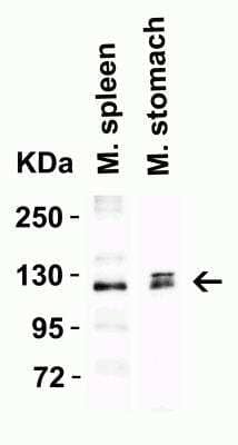 Western Blot: ACE-2 AntibodyBSA Free [NBP1-76614]