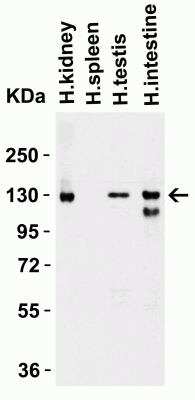 Western Blot: ACE-2 AntibodyBSA Free [NBP1-76614]
