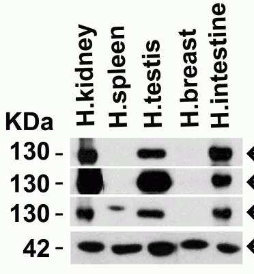 Western Blot: ACE-2 AntibodyBSA Free [NBP1-76614]