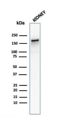 Western Blot: ACE/CD143 Antibody (ACE/3762)Azide and BSA Free [NBP3-08557]