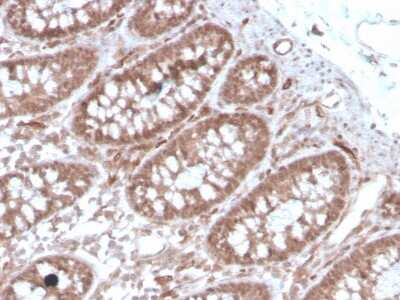 Immunohistochemistry-Paraffin: ACE/CD143 Antibody (ACE/3762) [NBP3-07607]