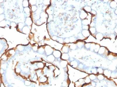 Immunohistochemistry-Paraffin: ACE/CD143 Antibody (ACE/3763) - Azide and BSA Free [NBP3-08558]
