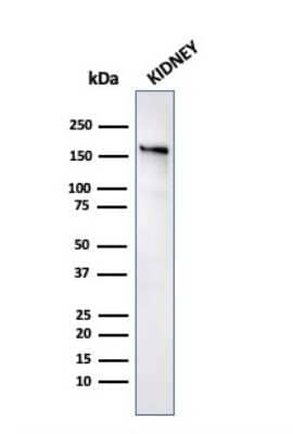 Western Blot: ACE/CD143 Antibody (ACE/3763)Azide and BSA Free [NBP3-08558]