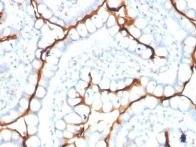 Immunohistochemistry-Paraffin: ACE/CD143 Antibody (ACE/3763) [NBP3-07608]