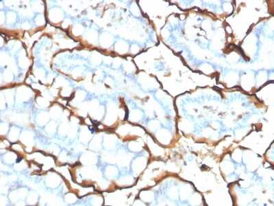 Immunohistochemistry-Paraffin: ACE/CD143 Antibody (ACE/3765) - Azide and BSA Free [NBP3-08497]