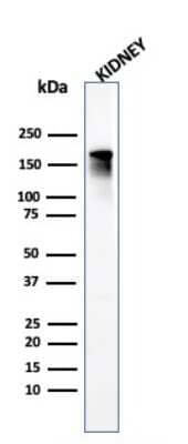 Western Blot: ACE/CD143 Antibody (ACE/3765)Azide and BSA Free [NBP3-08497]