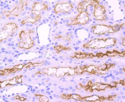 Immunohistochemistry-Paraffin: ACE/CD143 Antibody (JM59-32) [NBP2-67111]