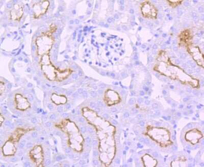 Immunohistochemistry-Paraffin: ACE/CD143 Antibody (JM59-32) [NBP2-67111]