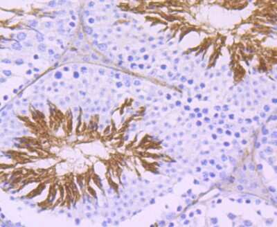 Immunohistochemistry-Paraffin: ACE/CD143 Antibody (JM59-32) [NBP2-67111]