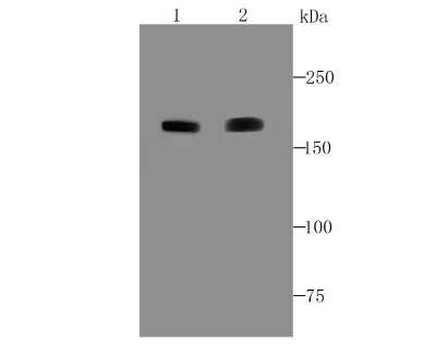 Western Blot: ACE/CD143 Antibody (JM59-32) [NBP2-67111]