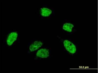 Immunocytochemistry/ Immunofluorescence: ACF Antibody [H00029974-B01P]