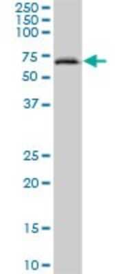 Western Blot: ACF Antibody [H00029974-B01P]