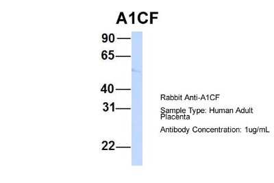 Western Blot: ACF Antibody [NBP1-57308]