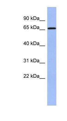 Western Blot: ACF Antibody [NBP1-57313]