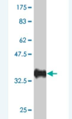 Western Blot: ACF1 Antibody (1F6) [H00011177-M01]