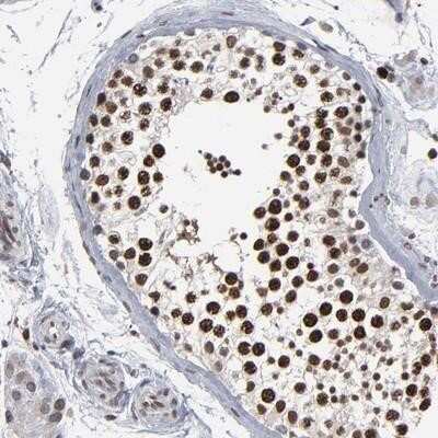 Immunohistochemistry: ACF1 Antibody [NBP1-90270]