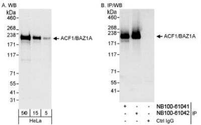 Western Blot: ACF1 Antibody [NB100-61041]