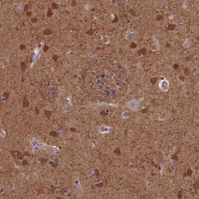 Immunohistochemistry-Paraffin: ACK1 Antibody [NBP1-90822]