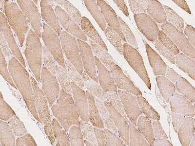 Immunohistochemistry-Paraffin: ACK1 Antibody [NBP2-97358]