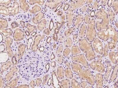 Immunohistochemistry-Paraffin: ACK1 Antibody [NBP2-97358]