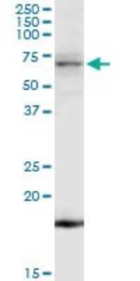 Western Blot: ACK1 Antibody [H00010188-D01P]